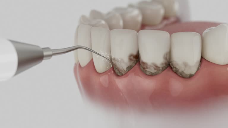 Trusted Emergency Dentist service in Briar Chapel, NC - Dentist Open Now